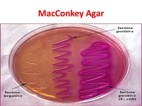 12.6.1: MacConkey Agar .
